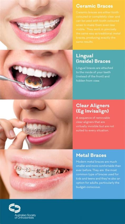 Braces For Adults What Are The Orthodontic Treatment Options