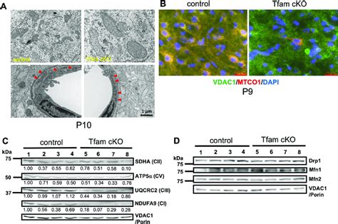 Mitochondrial Defects In Tfam Cko Mouse Brains A Ultrastructural