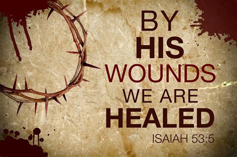 Pastoral Meanderings His Wounds Are His Glory And Our Healing
