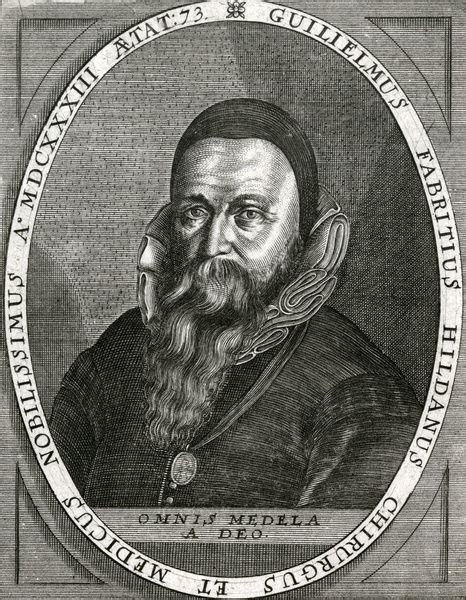 Photographic Print of WILHELM FABRICIUS German surgeon Date: 1580 1634 ...