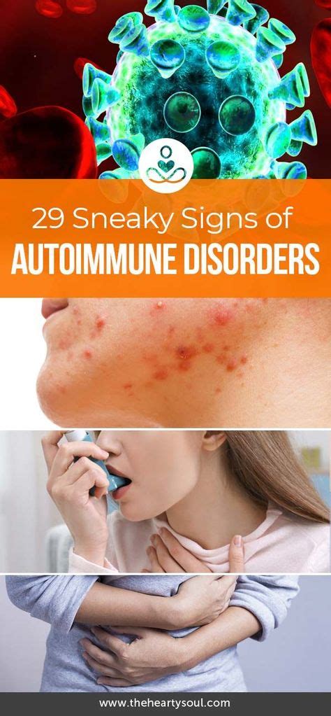 29 Signs That Show You Might Have An Autoimmune Disease Wellness