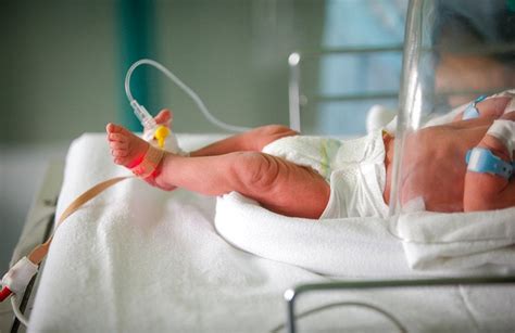 Terapia Intensiva Neonatal Qué Es Síntomas Y Tratamiento Top Doctors