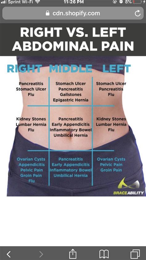 Back Pain Diagnosis Chart