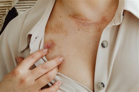 Skin Rashes Symptoms And When To See A Doctor
