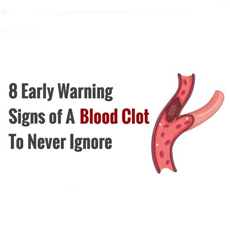 8 Early Warning Signs Of A Blood Clot To Never Ignore Power Of