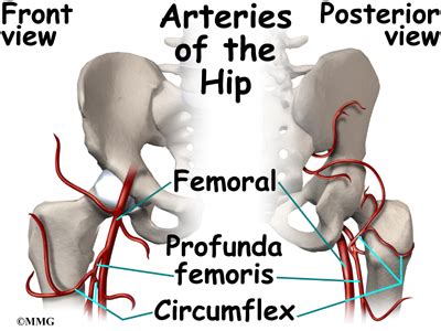 Perthes Disease | eOrthopod.com