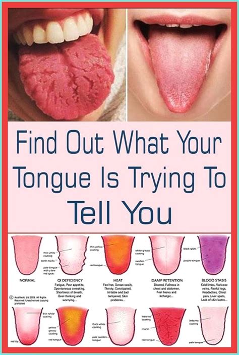 What Your Tongue Is Trying To Tell You About Your Health Healthy Brain