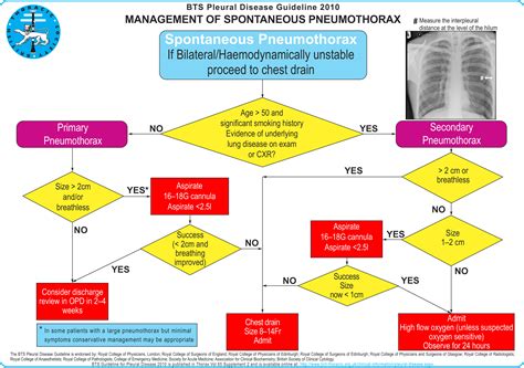 Pneumothorax Oxford Medical Education