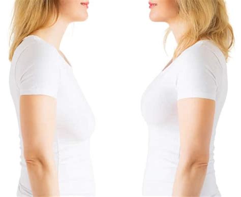 Breast Lift Surgery Breast Sagging Treatment