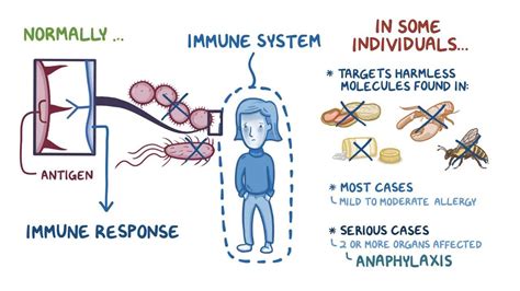 Anaphylaxis Video Anatomy Definition And Function Osmosis