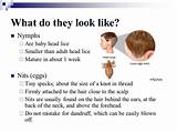Nix Head Lice Treatment Instructions Pictures