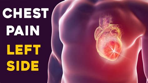 9 Effective Home Remedies To Get Rid Of Chest Pain Chest Pain Right