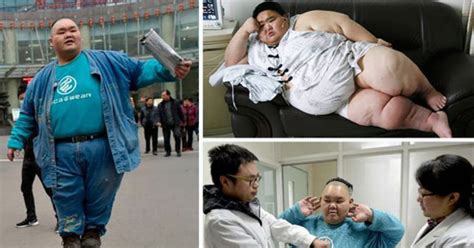 Chinas Fattest Man Who Weighed In At 35 Stone Sheds A Third Of His