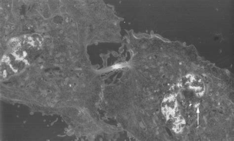 We did not find results for: Telophase - wikidoc