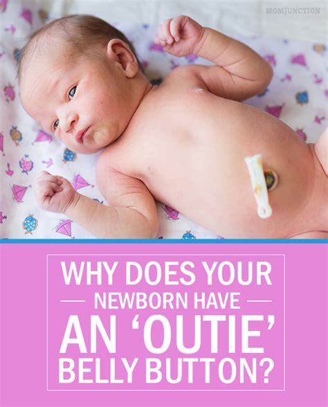 Why Does Your Newborn Have An ‘outie Belly Button