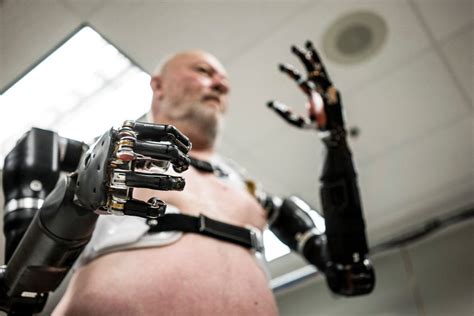 The Next Generation Of Prostheses Includes Artificial Arms With