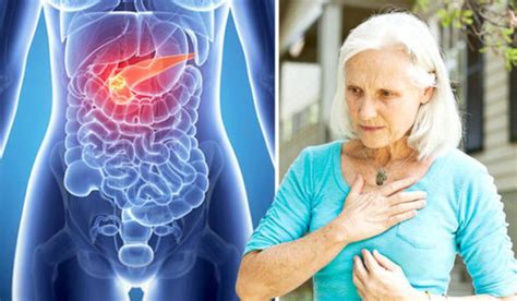 What Are The Symptoms Of Pancreatic Cancer In A Woman Canceroz