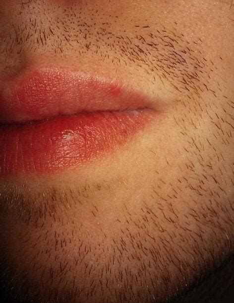 Skin Concerns Red Circle On Same Spot Of Lip Every Morning