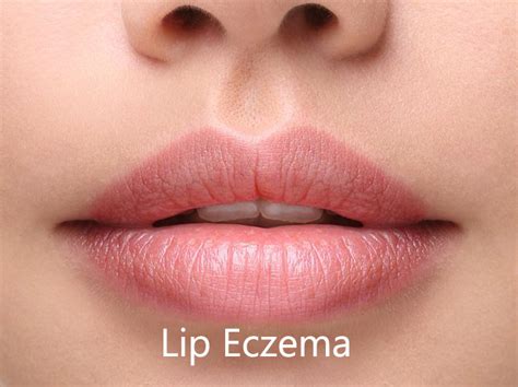 What Causes A Rash On Your Lips