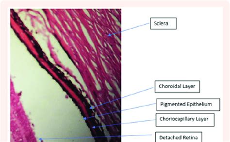 Histological Section Of The Human Choroid Where It Can See The