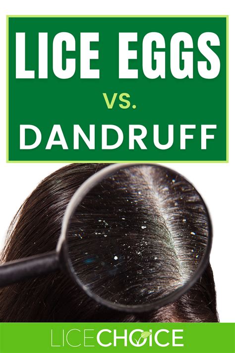 Difference Between Lice Eggs And Dandruff Query Full