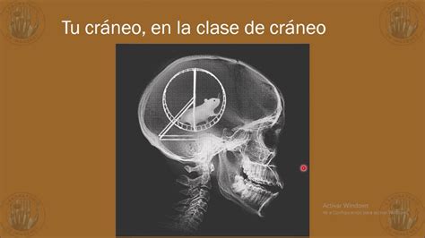 Anatomia Imagenologica Del Craneo Rx Tomografia Youtube