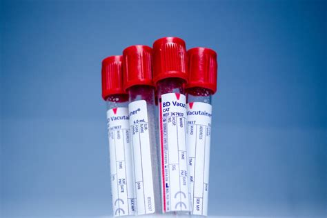Blood Tests Md365 Riset