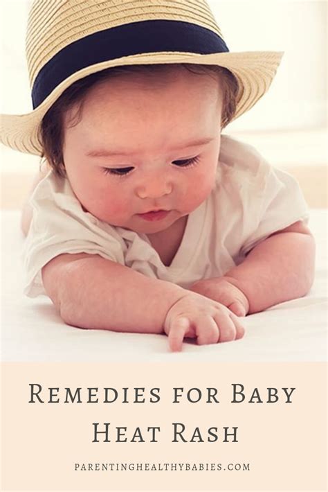 Baby Heat Rash 15 Must Know Home Remedies For Baby Heat Rash Baby