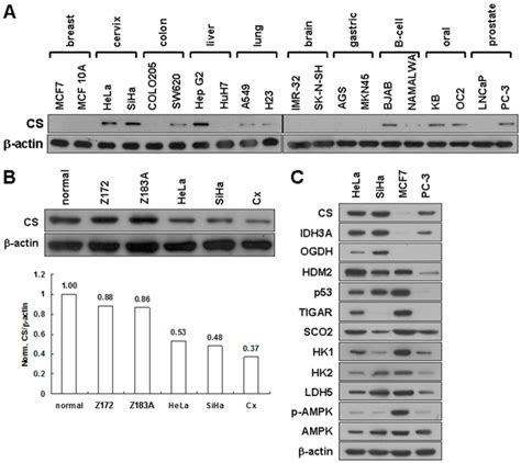 A Western Blotting Of Cs Expression In Various Cancer Cell Lines