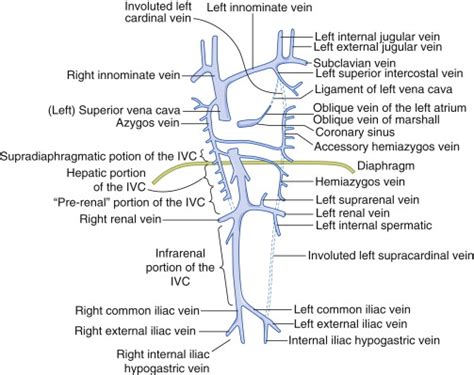 Caval Anatomy Variants And Lesions Radiology Key