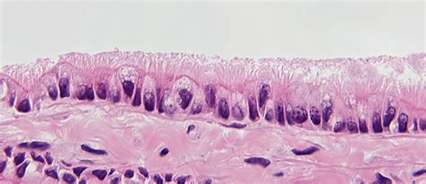 Langsam, geringe durchmesser niedrige innervationsschwelle und frequenz ausdauernd, kontraktionszeit lang geringe leitungsgeschwindigkeit. HISTOLOGIE: Lungen Gewebe, Alveolen, Makrophagen, Blut ...