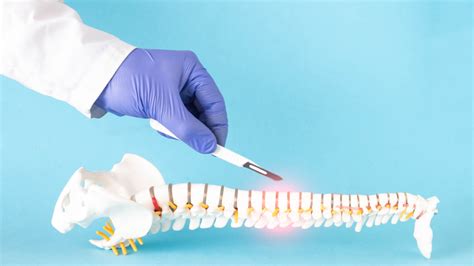 Vertebroplasty And Kyphoplasty Things To Know Precision Spine Care