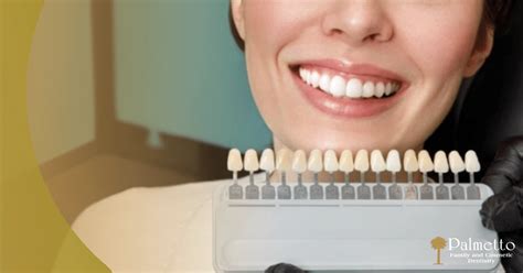 Columbia SC's Smile Makeover: Transform Smiles with Expert's Dental Veneers