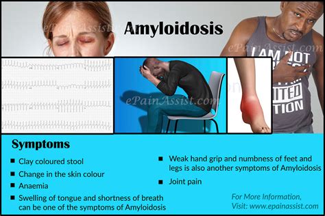 Amyloidosisprognosissurvival Ratetreatmentsymptomscausesdiagnosis