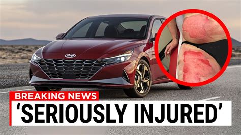 Hyundai Is Recalling 239000 Cars For Exploding Seat Belts Youtube