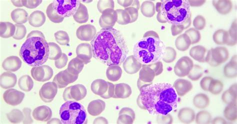 What Are Leukocytes Types Of Leukocytes