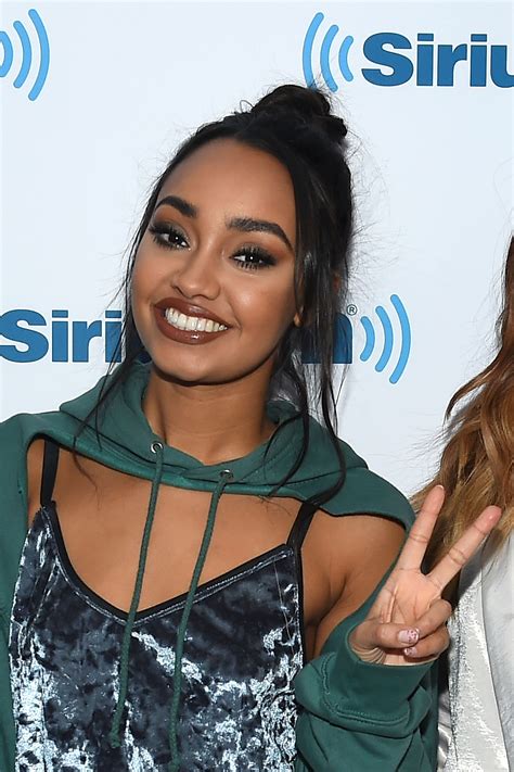 Little Mix S Leigh Anne Pinnock Snapchats A Painful Looking Bruise On Her Face Teen Vogue