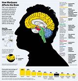 Images of Marijuana On The Teenage Brain