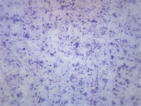 Eisco Bacillus Mixed Gram Positive And Negative 1 X 3 In 25 X 77 Mm