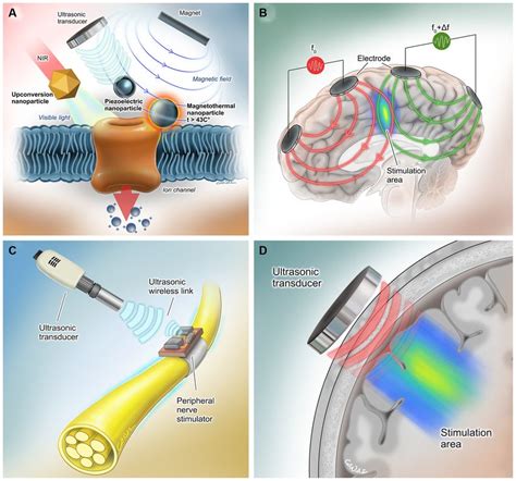 Implantable Pulse Generators For Deep Brain Stimulation Challenges