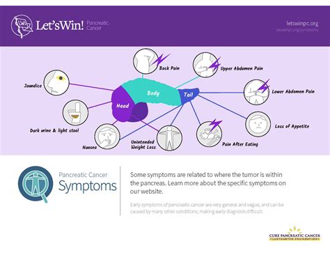 The bile duct is the tube that takes bile from the liver to the duodenum (which is the first part of the small intestine). Let's Win Pancreatic Cancer on Twitter: "#PancreaticCancer ...