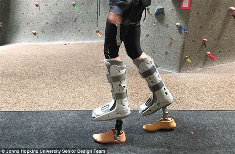 The Prosthetic Foot That Lets Women Wear Everything From Sneakers To