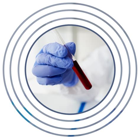 Clinical Blood Testing Navis Clinical Laboratories