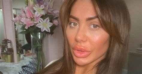 Chloe Ferry Ditches Instagram Filters And Makeup As Stars Embrace