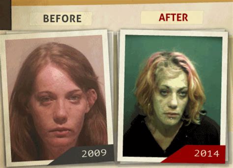 Photos Before And After Faces Of Addiction Pictures Show Impact Of Drugs On Men Women Wjla
