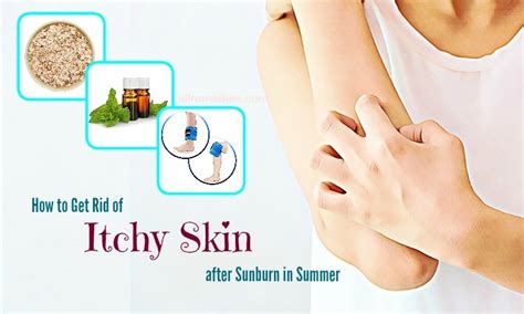 22 Remedies How To Get Rid Of Itchy Skin After Sunburn In Summer