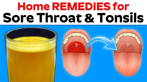 Home Remedies For Sore Throat And Swollen Tonsils Health And Safety