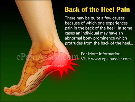 Pin On Foot Paincauses Treatment