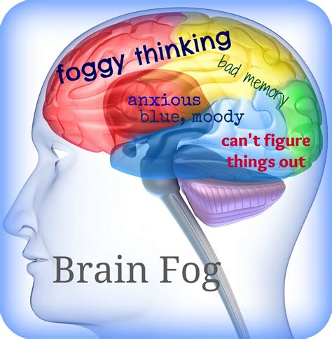 Brain Fog Symptoms And How You Can Fix Them Just In Health
