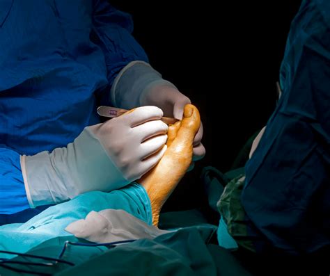 Foot And Ankle Surgery In Cary NC Ankle And Foot Doctors